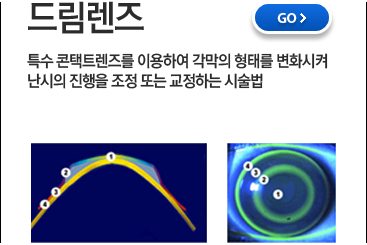 드림렌즈